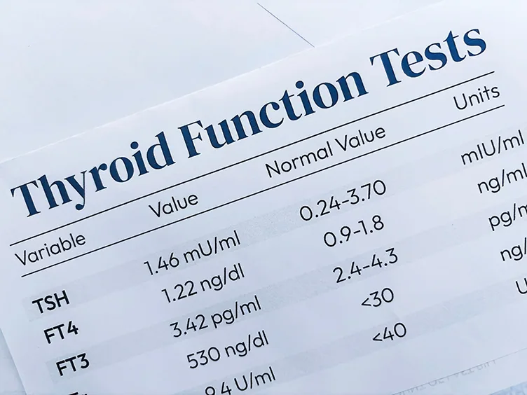 Thyroid function test results showing TSH, FT4, and FT3 values with normal reference ranges